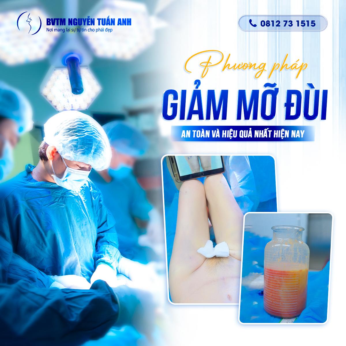 Phương pháp giảm mỡ đùi an toàn và hiệu quả nhất hiện nay