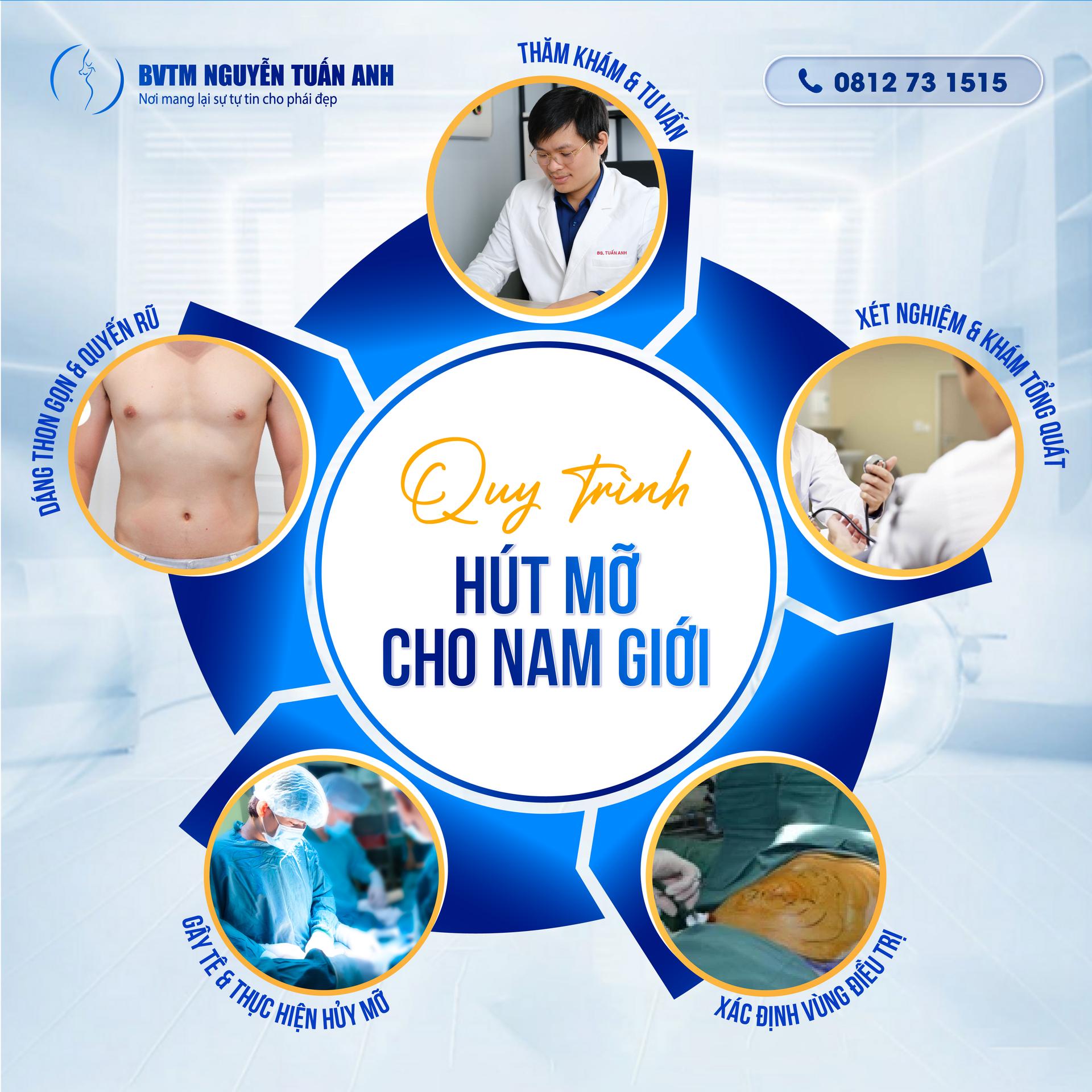 Hút mỡ cho nam giới là gì?