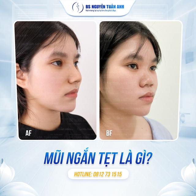 Dịch vụ thẩm mỹ