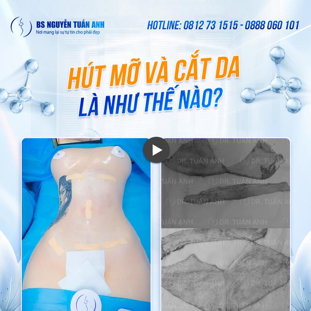 Dịch vụ thẩm mỹ