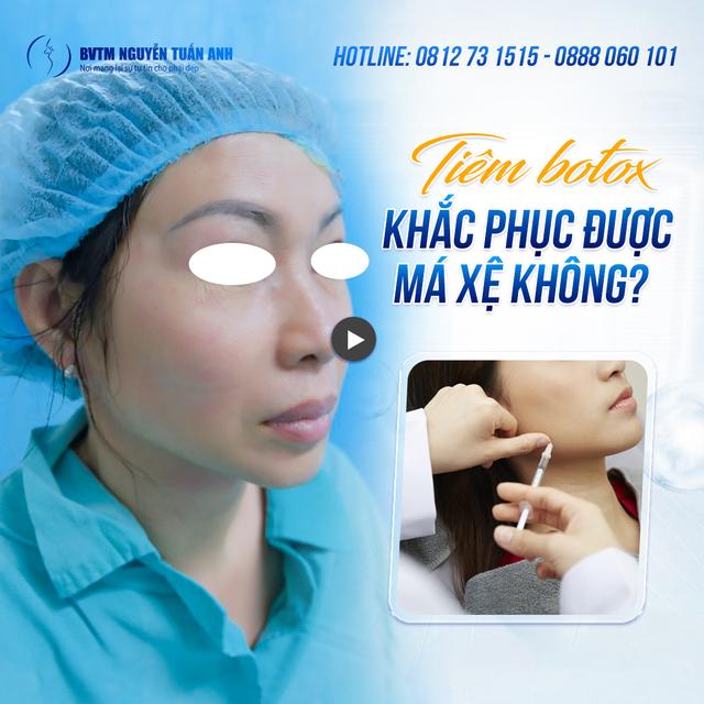 Dịch vụ thẩm mỹ