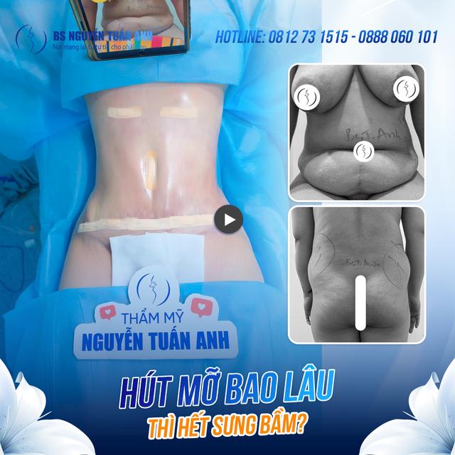 Dịch vụ thẩm mỹ