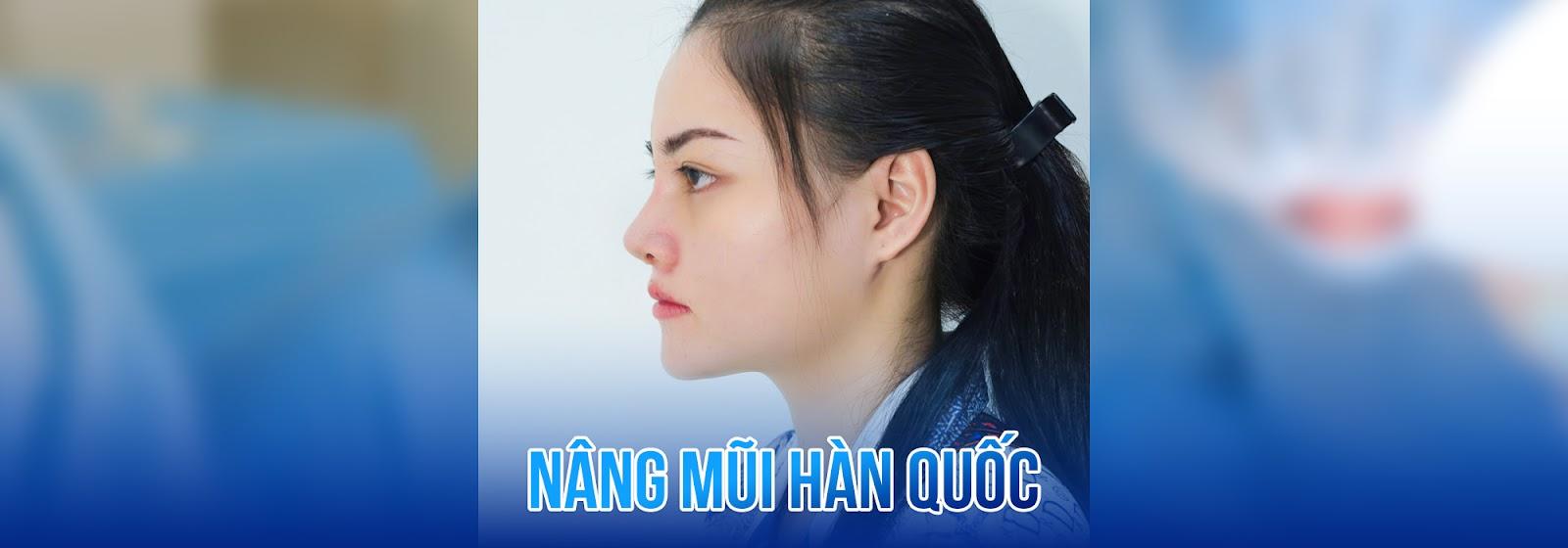 Nâng Mũi Cấu Trúc Hàn Quốc