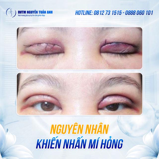 Dịch vụ thẩm mỹ