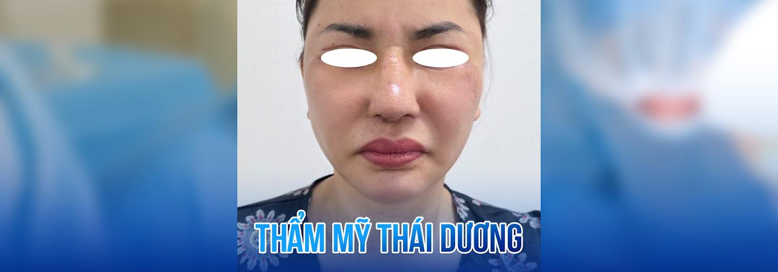Dịch vụ thái dương