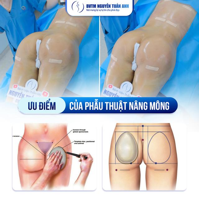 Dịch vụ thẩm mỹ