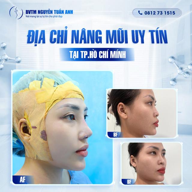 Dịch vụ thẩm mỹ