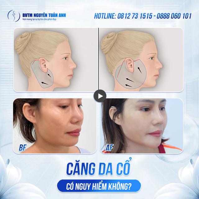 Dịch vụ thẩm mỹ