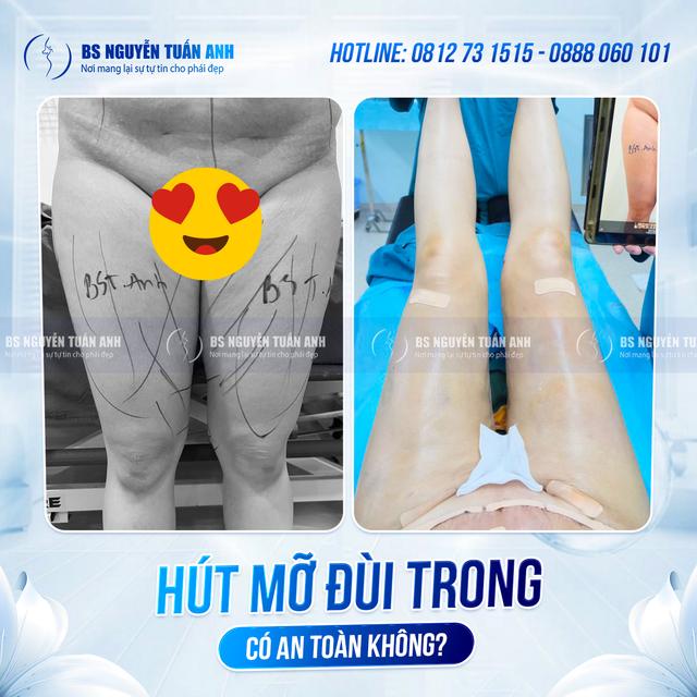Dịch vụ thẩm mỹ