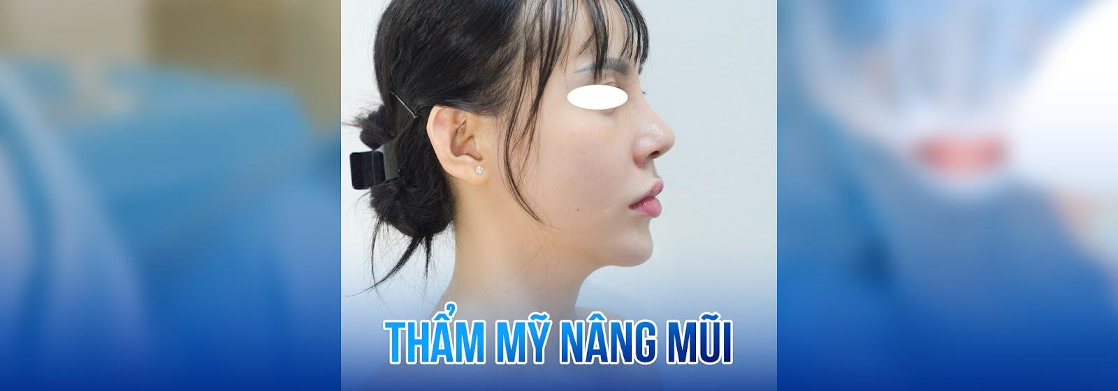 Dịch vụ nâng mũi
