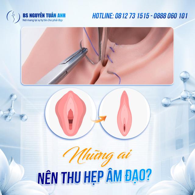 Dịch vụ thẩm mỹ
