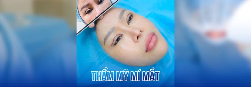 Dịch vụ mí mắt