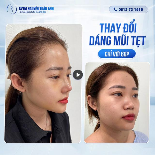 Dịch vụ thẩm mỹ