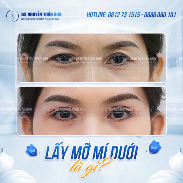 Dịch vụ thẩm mỹ