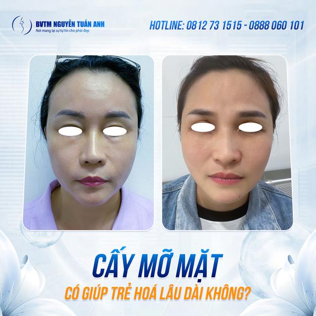 Dịch vụ thẩm mỹ