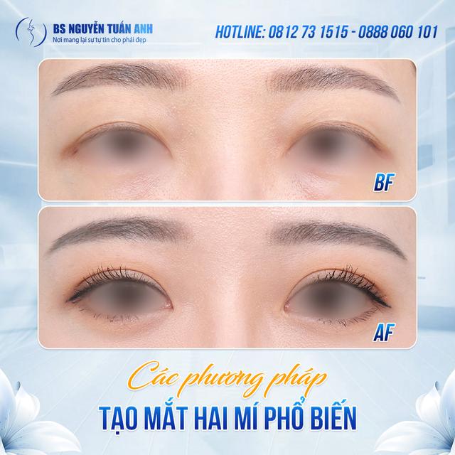Dịch vụ thẩm mỹ