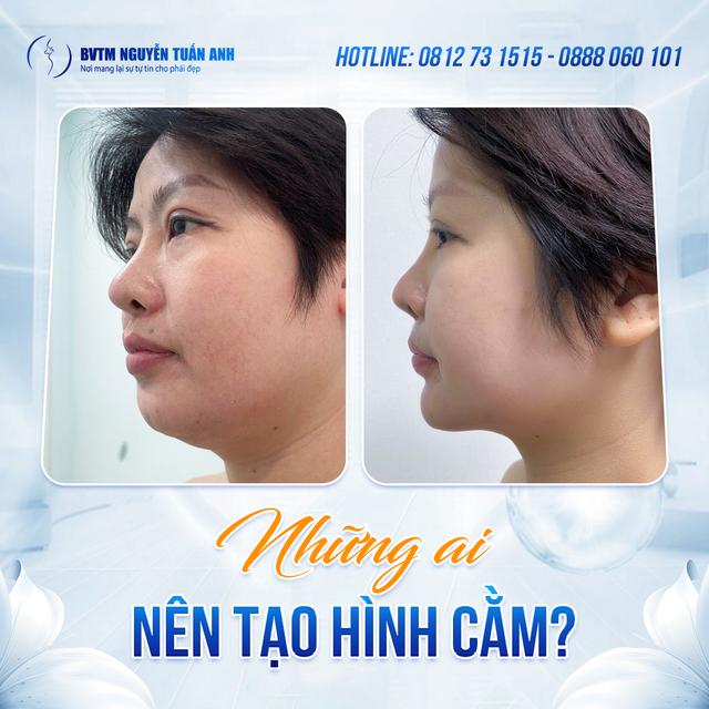 Dịch vụ thẩm mỹ