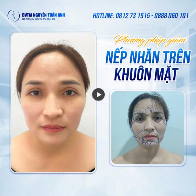 Dịch vụ thẩm mỹ