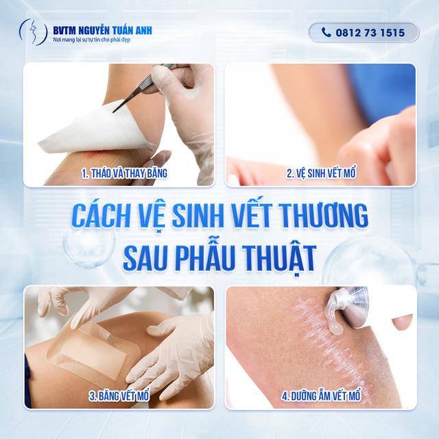Dịch vụ thẩm mỹ