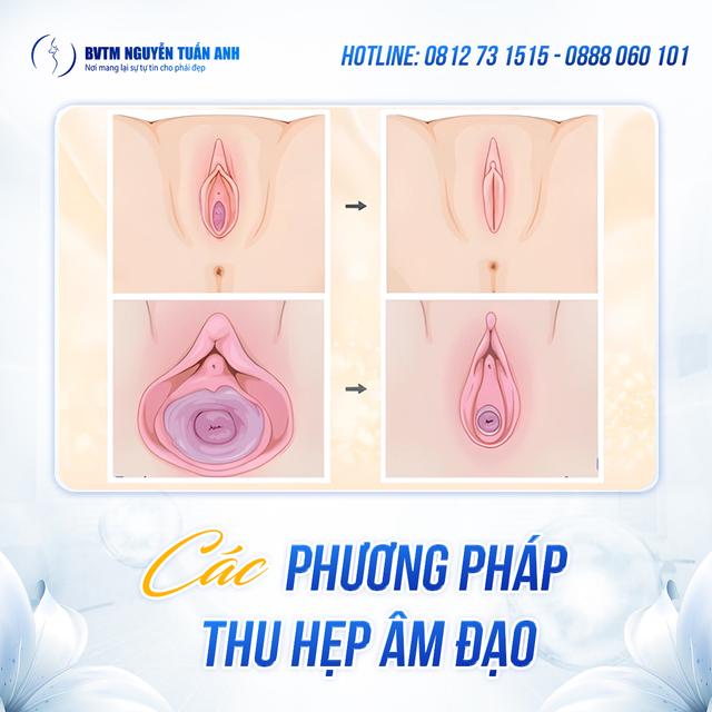 Dịch vụ thẩm mỹ