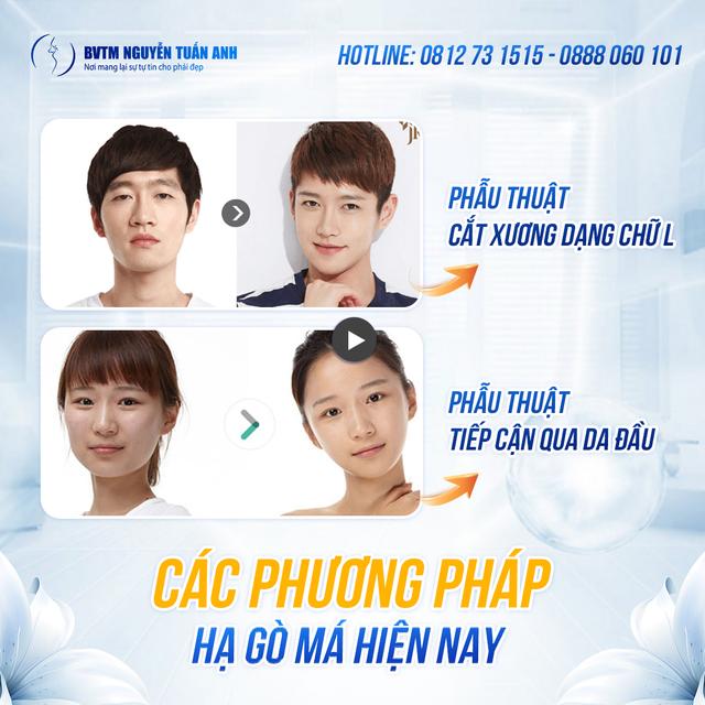 Dịch vụ thẩm mỹ