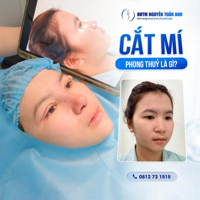 Dịch vụ thẩm mỹ